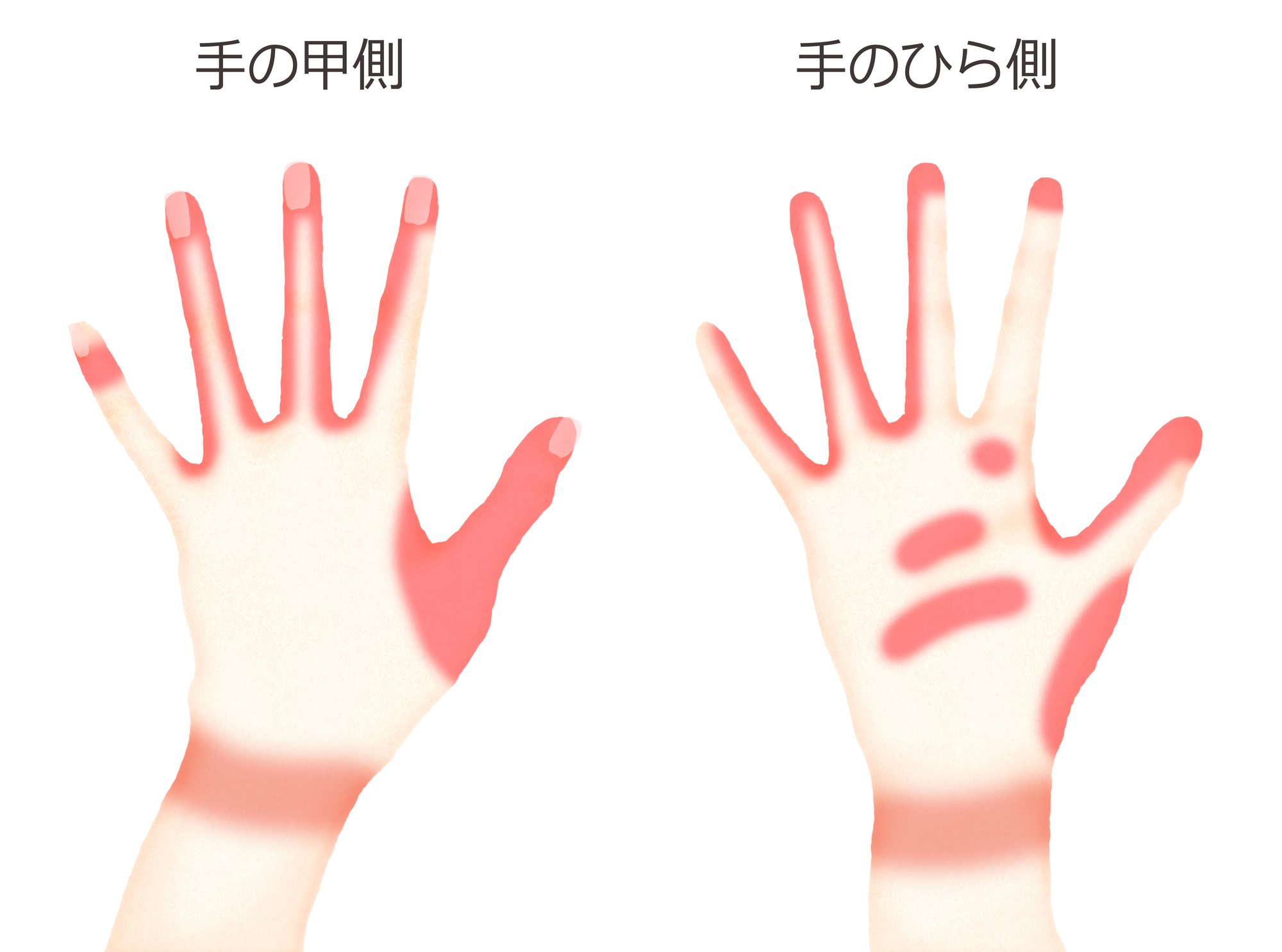 手の洗い残しやすい部分